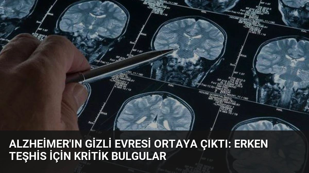 Alzheimer’ın Gizli Evresi Ortaya Çıktı: Erken Teşhis İçin Kritik Bulgular