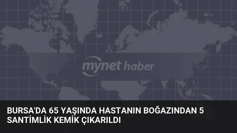 Bursa’da 65 Yaşında Hastanın Boğazından 5 Santimlik Kemik Çıkarıldı