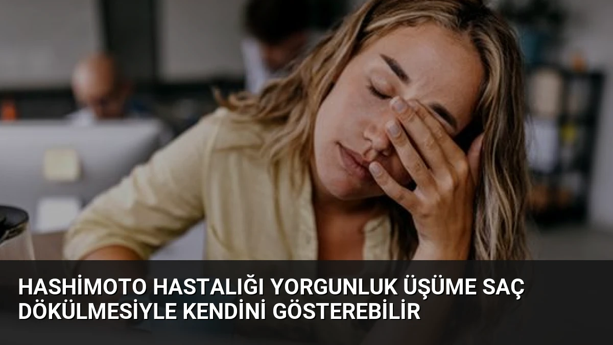 Hashimoto Hastalığı Yorgunluk Üşüme Saç Dökülmesiyle Kendini Gösterebilir