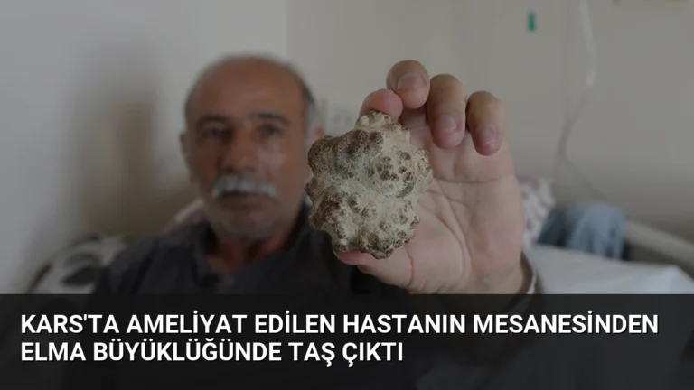 Kars’ta Ameliyat Edilen Hastanın Mesanesinden Elma Büyüklüğünde Taş Çıktı