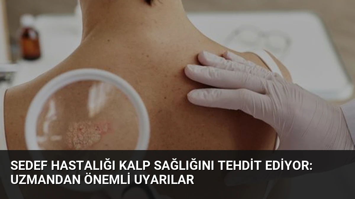 Sedef Hastalığı Kalp Sağlığını Tehdit Ediyor: Uzmandan Önemli Uyarılar