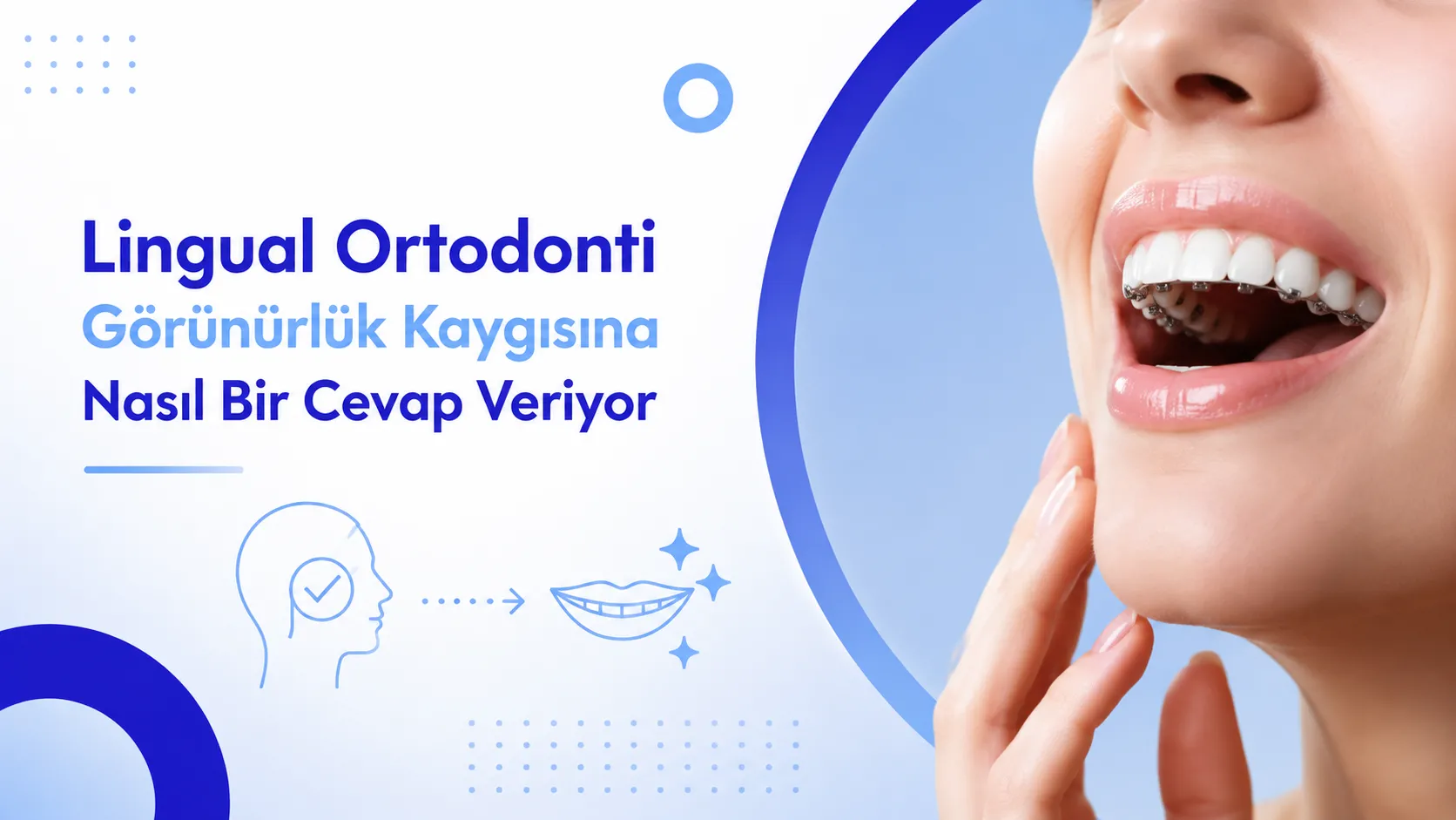 Lingual Ortodonti Görünürlük Kaygısına Nasıl Bir Cevap Veriyor